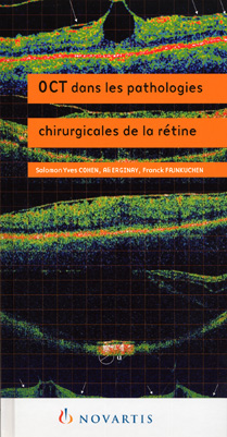 tomographie coherence optique oct novartis optical coherence tomography