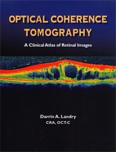 oct optical coherence tomography darrin landry