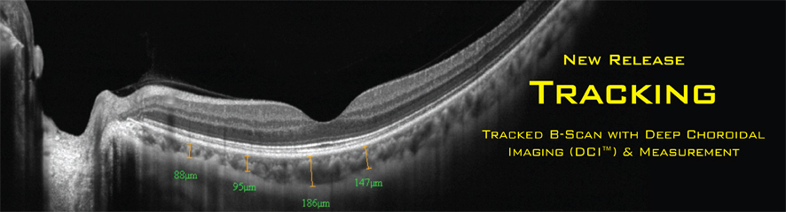 tracking oct optovue retina choroid