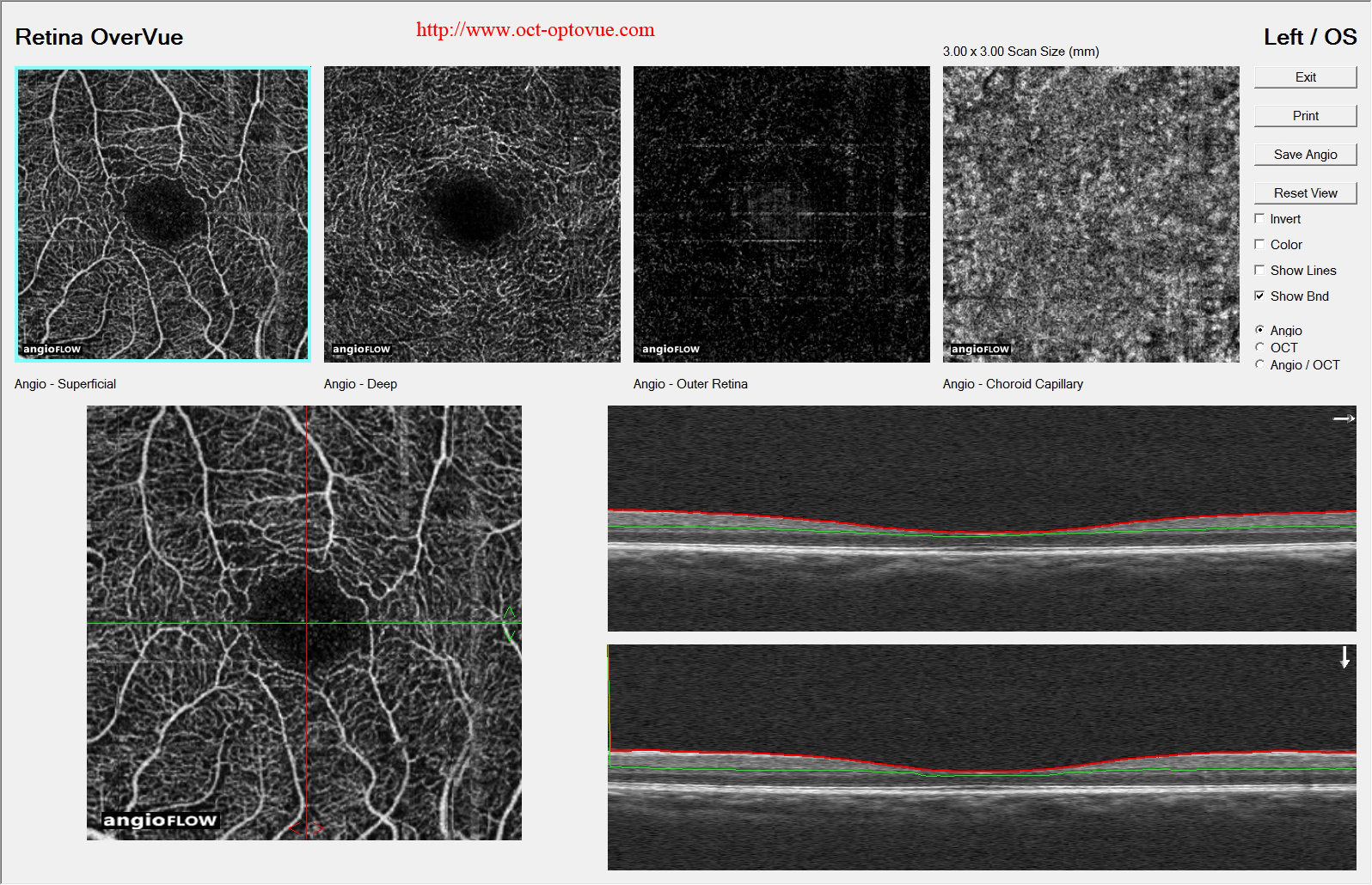 mactel fellow-eye