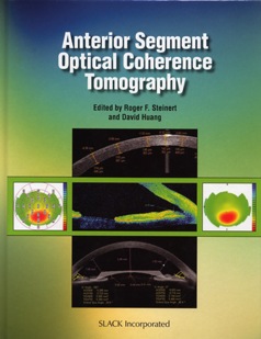 anterior segment oct optical coherence tomography