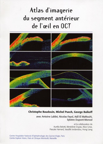 anterior segment optical coherence tomography oct sa