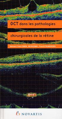 tomographie coherence optique oct novartis optical coherence tomography