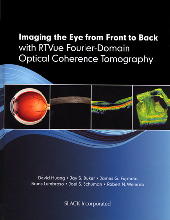 imaging the eye from front to back rtvue huang lumbroso duker schuman