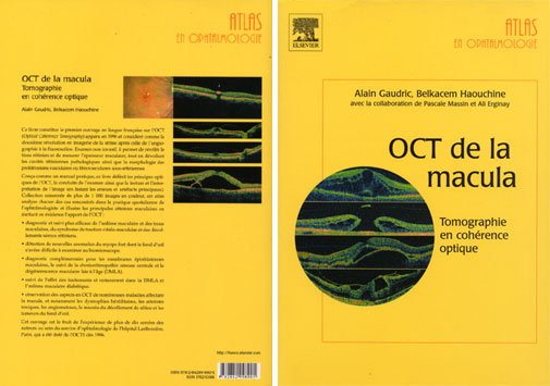 oct macula gaudric haouchine livre book retina