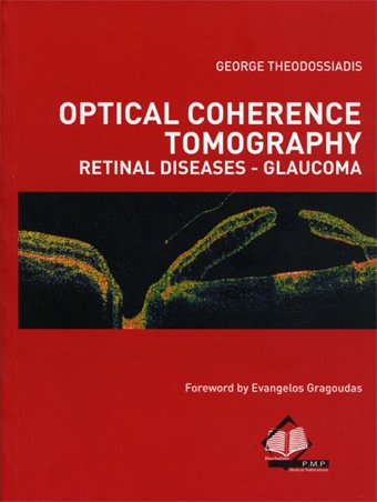 optical coherence tomography theodossiadis