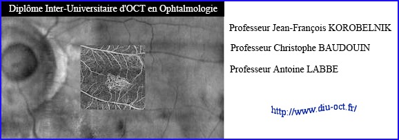 diu oct ophtalmologie korobelnik baudouin labbe