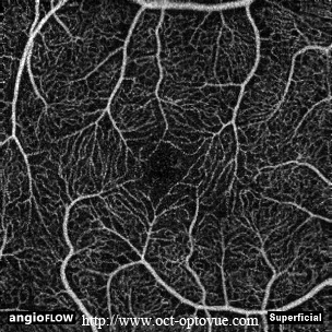 superficial retina angio oct muratet pamiers france