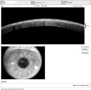 groenouw groenouv gronouw groenouew cornea