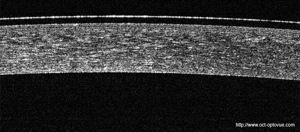 lentille souple oct optovue sofltens