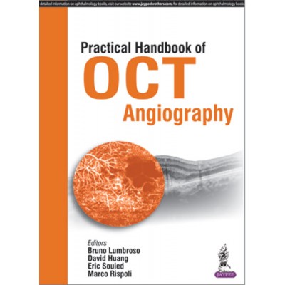 practical handbook of oct angiography lumbroso 2016