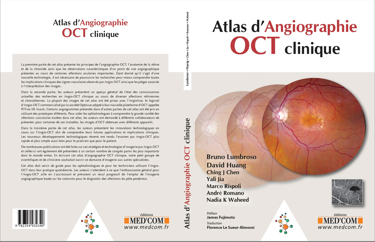 Atlas d'Angiographie OCT Clinique B.Lumbroso, D. Huang, C.J. Chen, Y.Jia, M.Rispoli, A.Romano, N.K.Waheed
