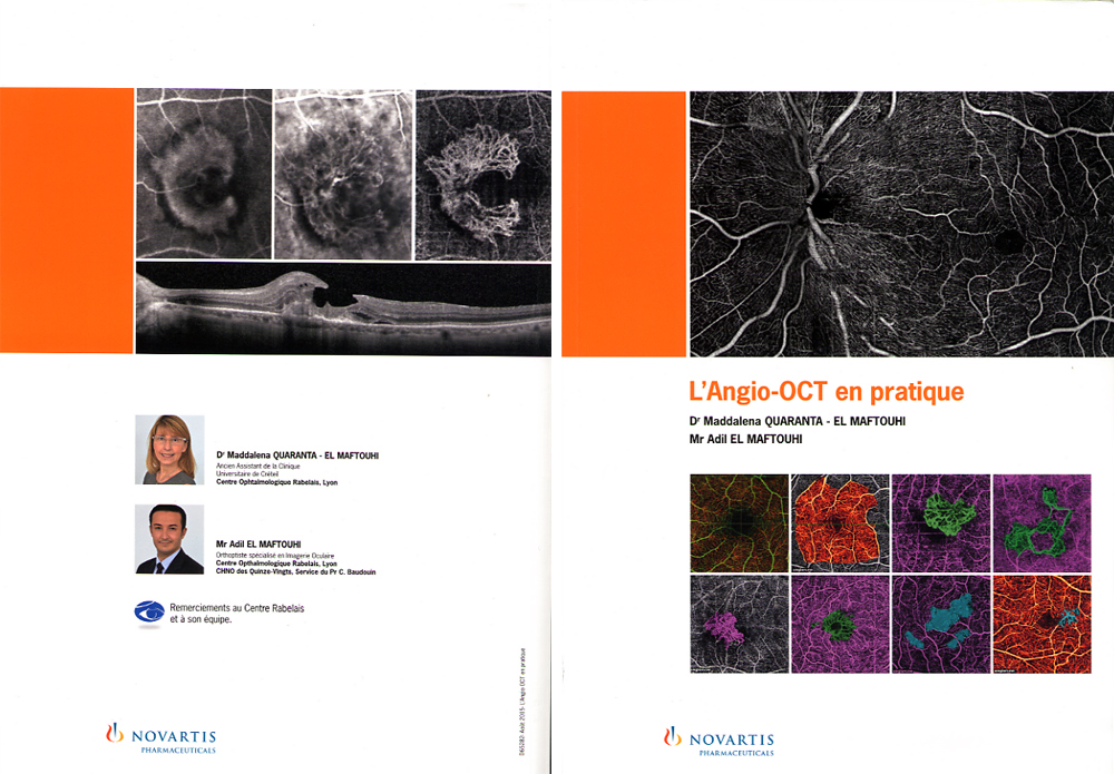 quaranta maftouhi book l'angio-OCT en pratique Novartis