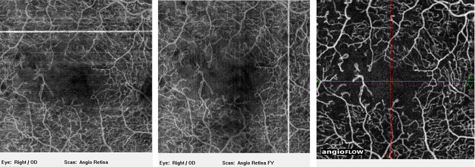 vertical horizonal raster remove shearing errors