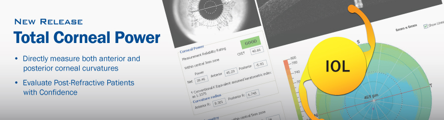 oct optovue total corneal power